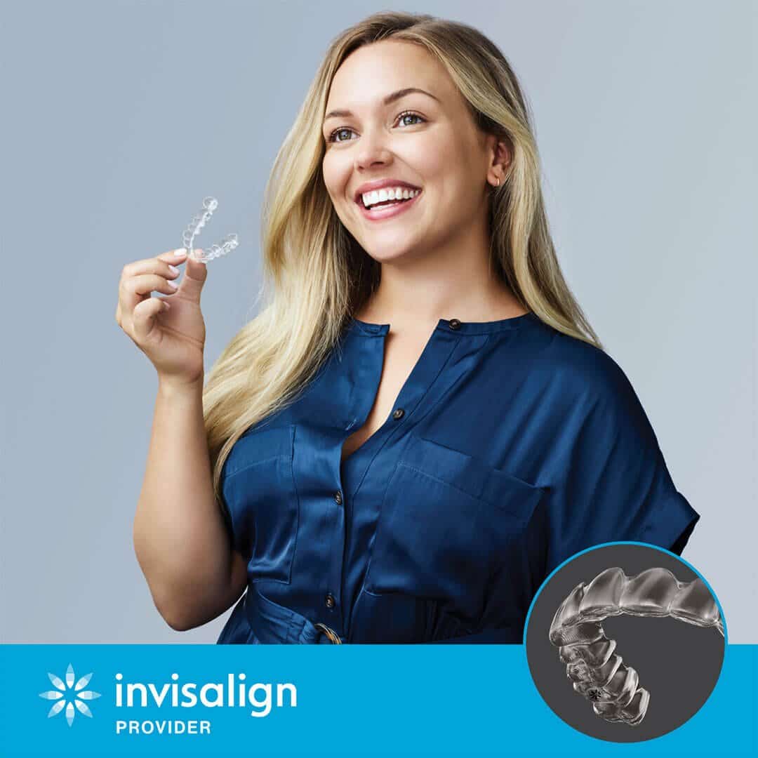 Aligners