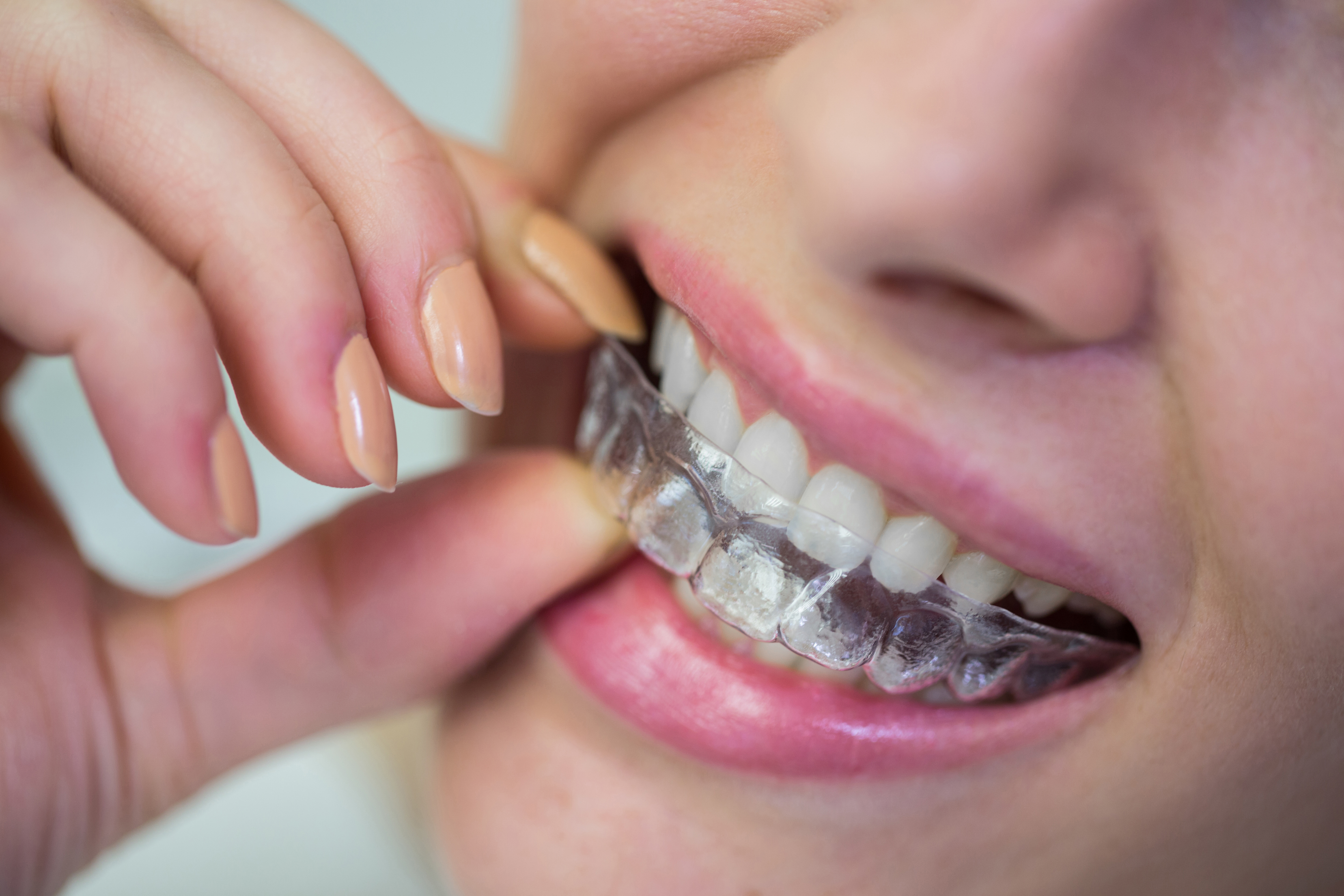 Dental X-ray